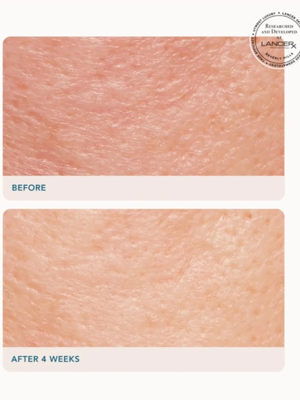Dr. Lancer's Retexturizing Treatment 10% GLYCOLIC ACID + COQ10